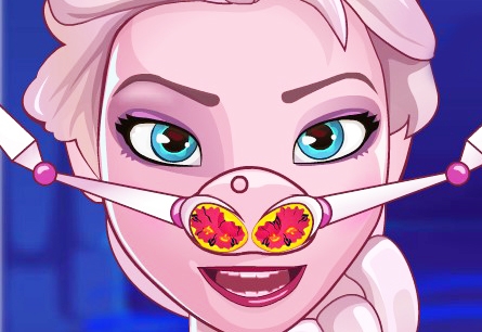 Игра Холодное Сердце: Лечим Нос