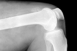 Игра Больное Колено