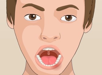 Игра Зубной Имплантат